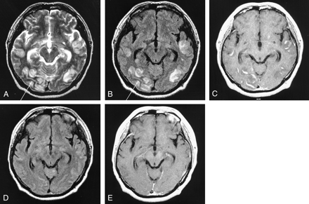 Fig 3.
