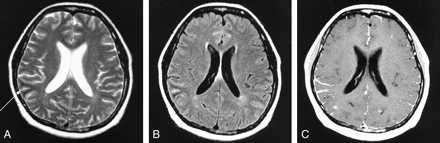 Fig 4.