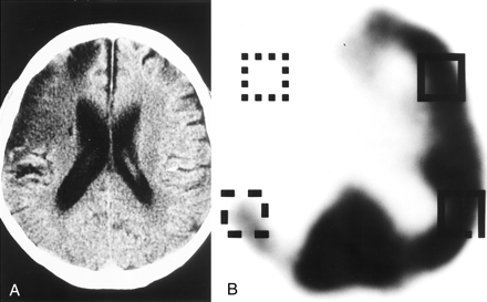 Fig 2.