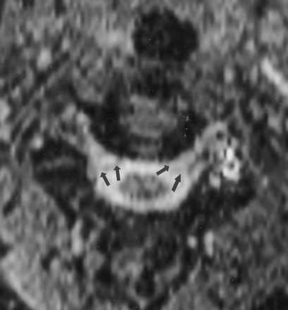 Fig 5.