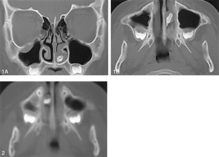 Fig 2.