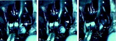 Fig 4.