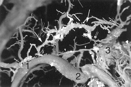 Fig 2.