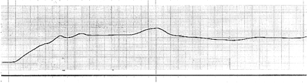 Fig 4.