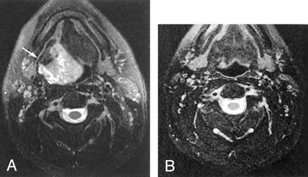 Fig 3.