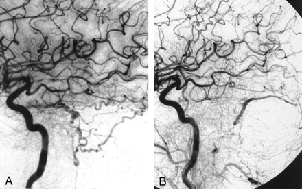 Fig 2.