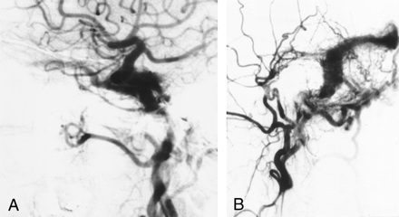 Fig 3.