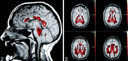 Fig 3.