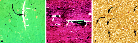 Fig 4.