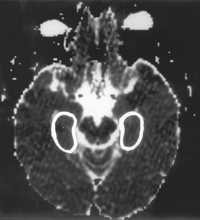 Fig 1.