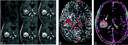 Fig 3.