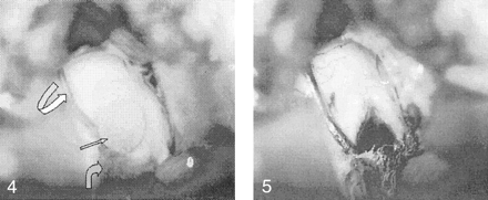 Fig 4.