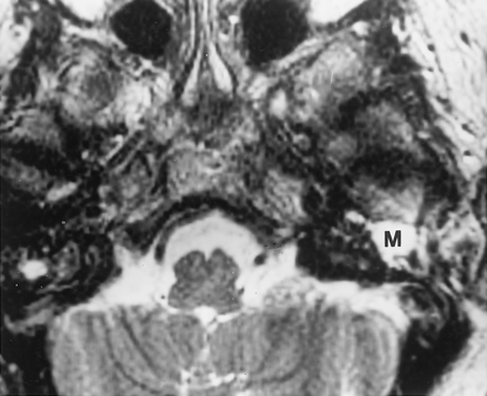 Fig 2.
