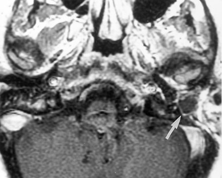 Fig 3.