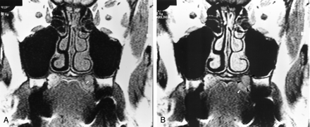 Fig 3.