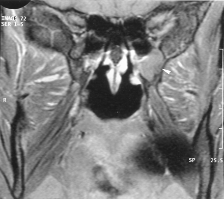 Fig 6.