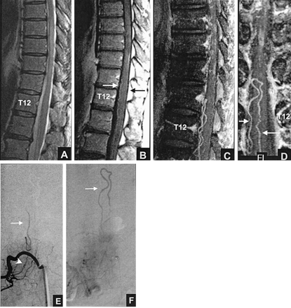 Fig 2.