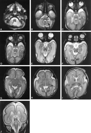 Fig 3.