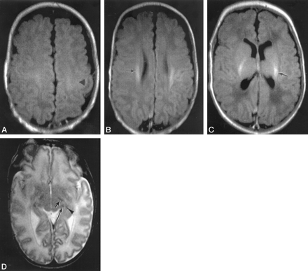Fig 4.