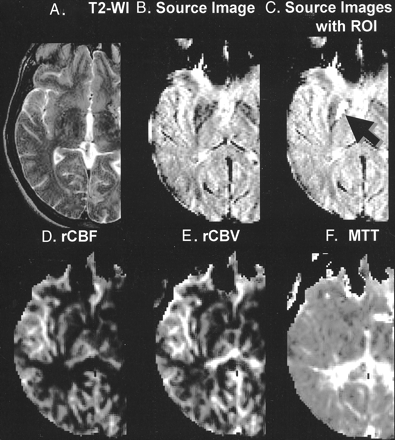 Fig 1.