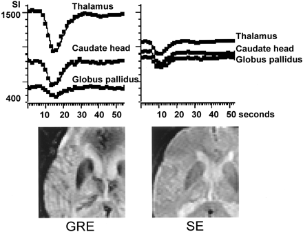 Fig 3.