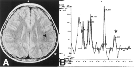 Fig 1.