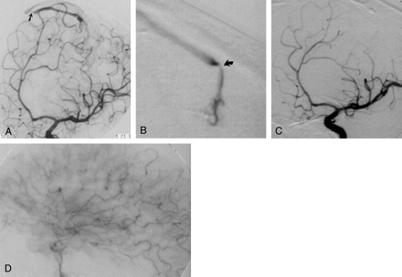 Fig 3.