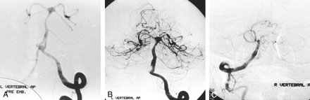 Fig 5.