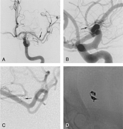 Fig 3.