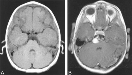 Fig 1.