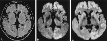Fig 2.