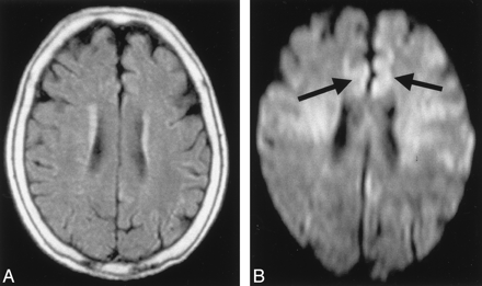 Fig 3.