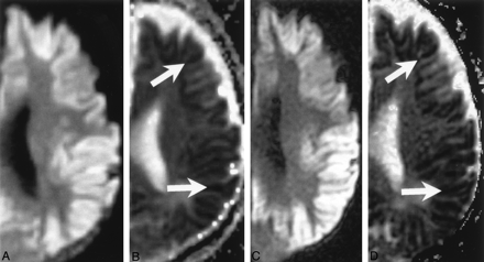 Fig 7.