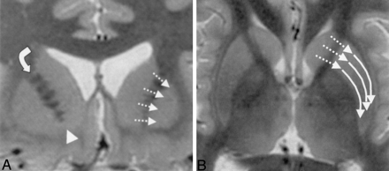 Fig 8.