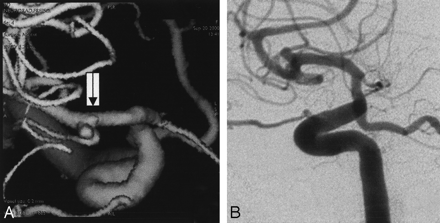 Fig 1.