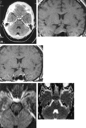 Fig 2.