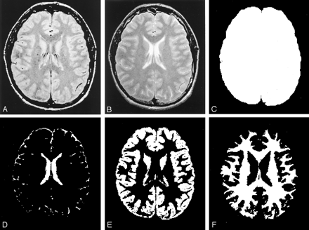 Fig 1.