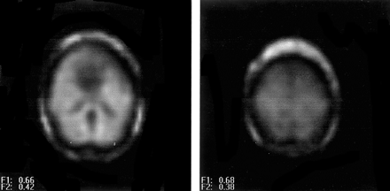Fig 4.