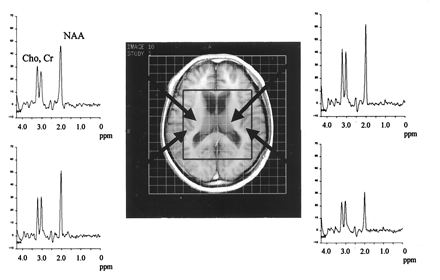 Fig 1.