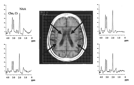 Fig 2.