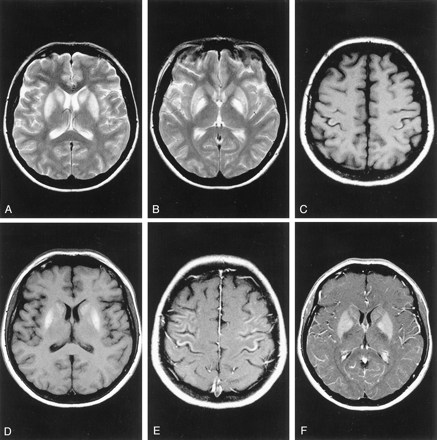 Fig 2.