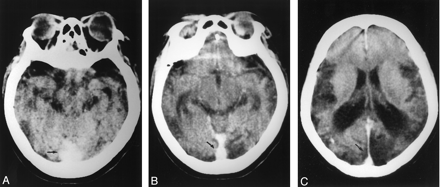 Fig 1.