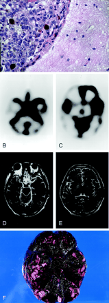 Fig 1.