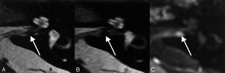 Fig 4.