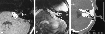 Fig 1.