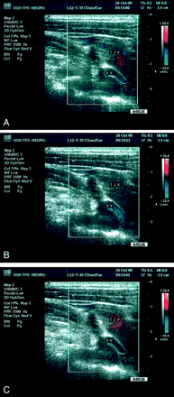 Fig 2.