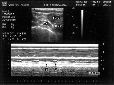 Fig 3.