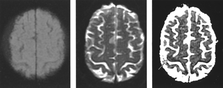 Fig 3.