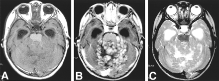 Fig 1.