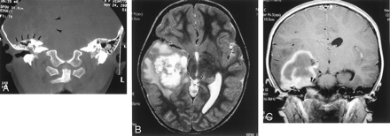 Fig 1.